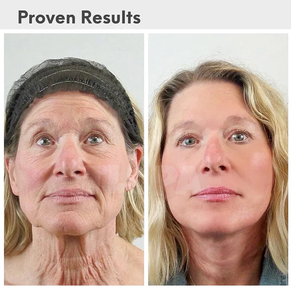 Fivfivgo™ Luxury Collegan Boost Hyaluronsäure-Anti-Aging-Serum - Image 7