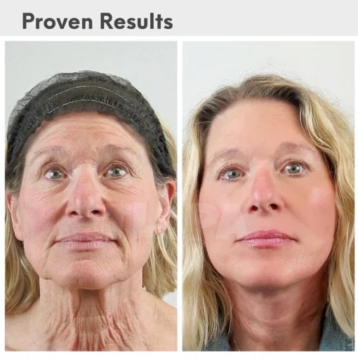 TLOPA® Luxury Hyaluronic Acid Anti-Aging Serum - Image 6