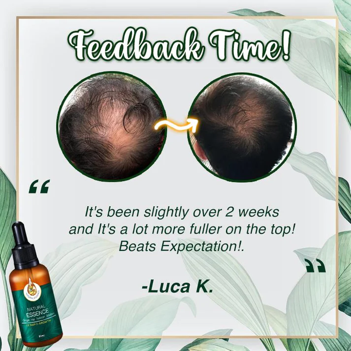 Ginger 7X Rapid Hairup Serumđ„Refund immediately if there is no effect after use! - Image 4