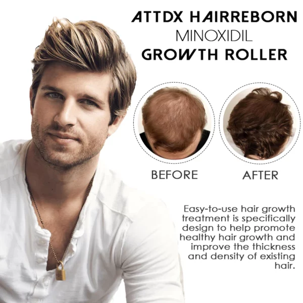 ATTDX HairReborn Minoxidil Growth Roller - Image 6