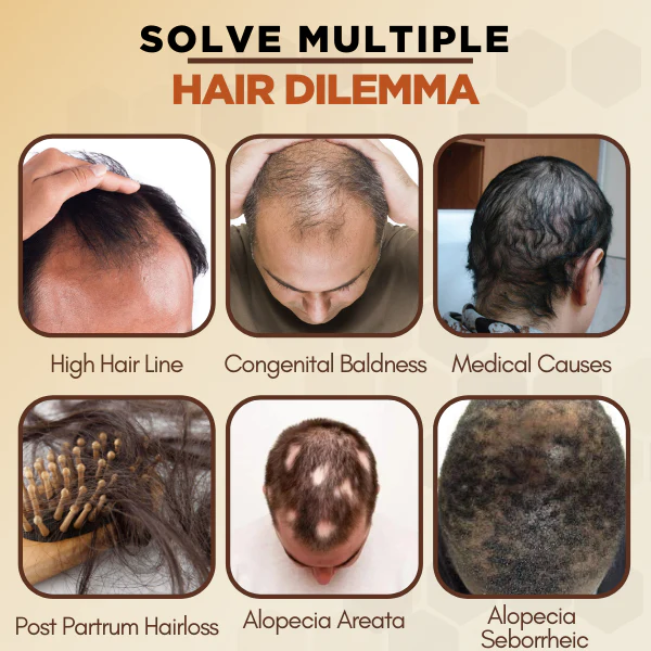 Regrowth™ Nourishing Ginger Spray - Image 6