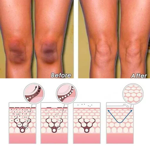 BioLap™ Dark Spot Correcting Cream - Image 7