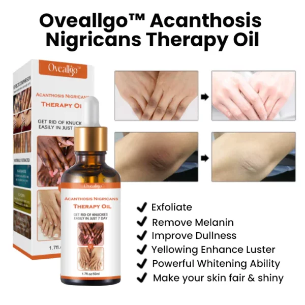 Oveallgo™ Acanthosis Nigricans Therapy Oil - Image 3