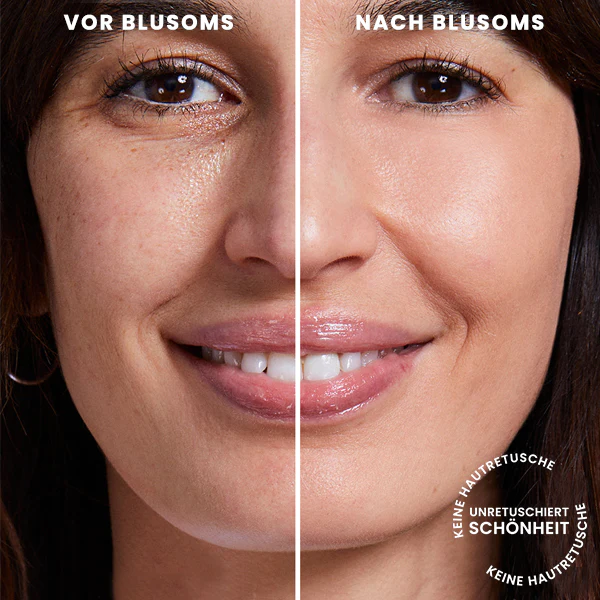 Blusoms™ Extra Erneuernder Hagebutten-Augenbalsam - Image 5