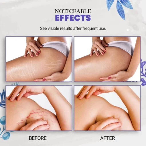 EarthBlend™ Stretch Mark Vanisher - Image 7