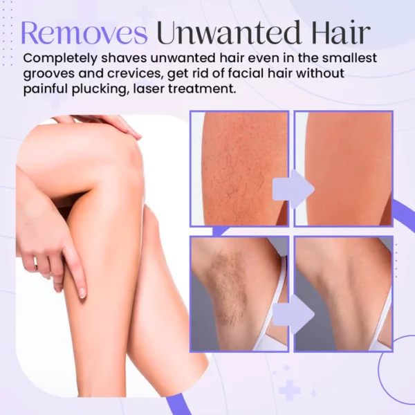 BeamBlade™ Laser Sensitive Shaver - Image 3