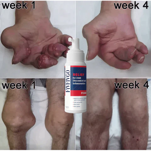 Fivfivgo™ TherapyX Gelenk- und Knochentherapieschaum - Image 5