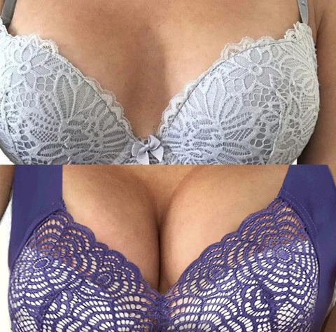 Lymphvity Detoxification and Shaping & Powerful Lifting BH - Image 3