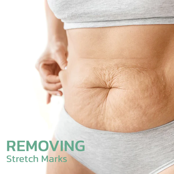 flysmus™ BeautyWomen Collagen Lifting Körperöl - Image 8