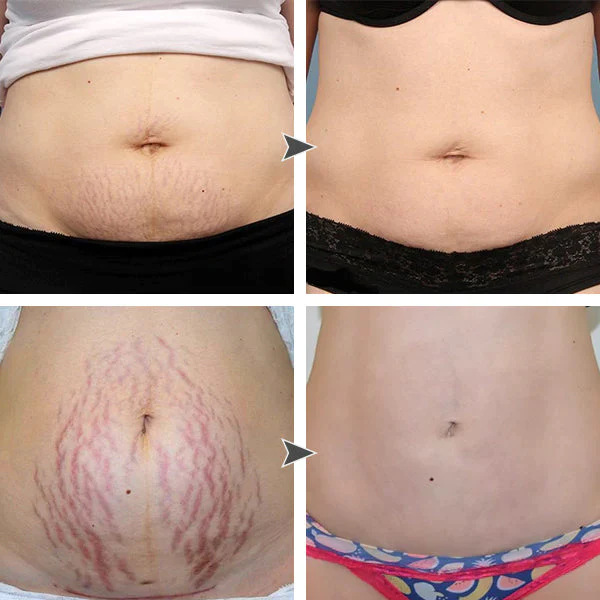 PASTEL Anti-Cellulite Slimming Cream - Image 4