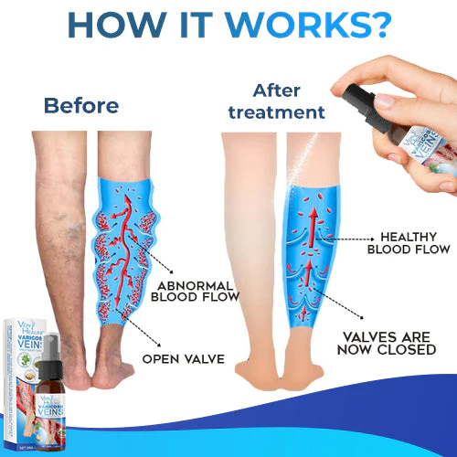 Veinhealing Varicose Veins Treatment Spray - Image 8