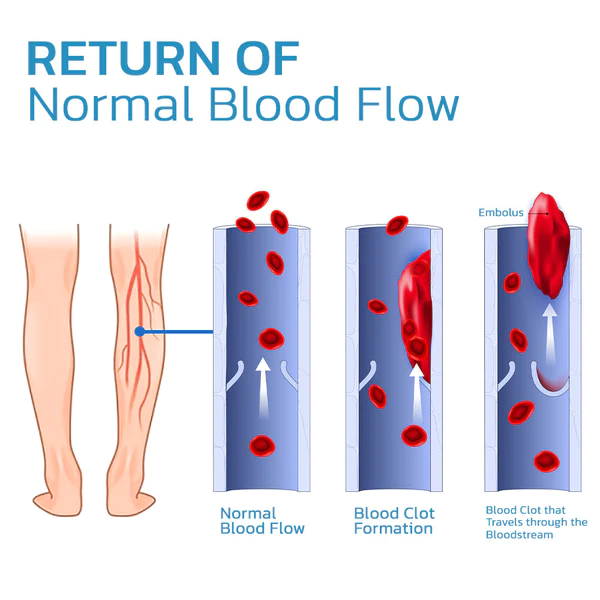 GFOUK™ TitanVein Fern-Infrarot-Turmalin-Akupressur-Einlagen - Image 6