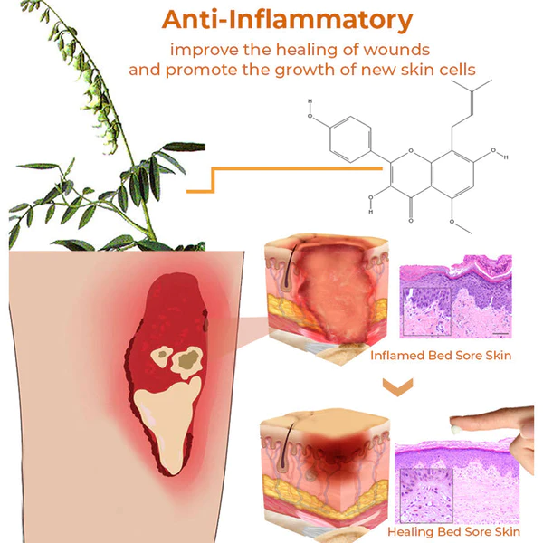 MX™ Bed Sore Treatment Cream - Image 5