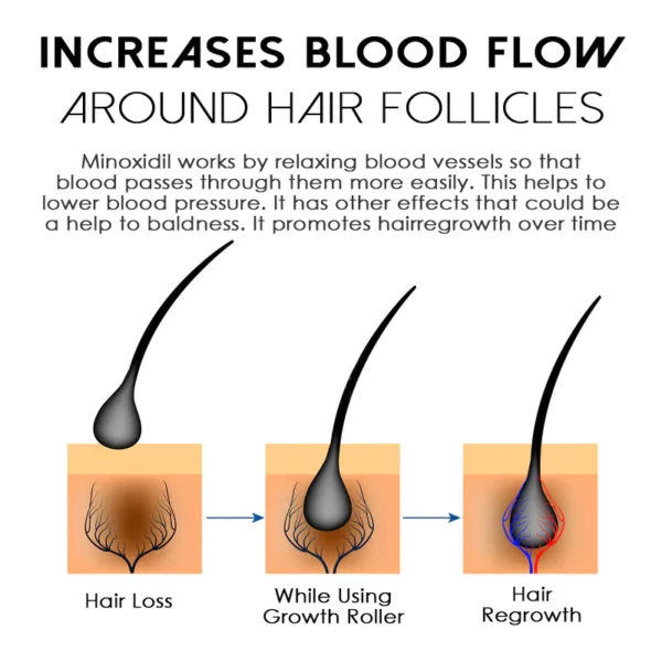 ATTDX HairReborn Minoxidil Growth Roller - Image 5