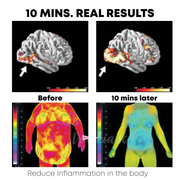 Ricpind TitaniumTherapy CelluBurn SpinnerRing - Image 6