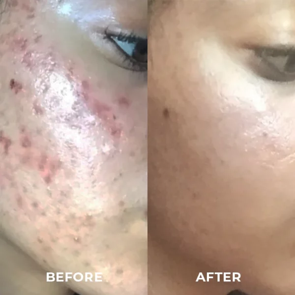 Skinetic™ Single-Packaged Eggplants Mud Mask - Image 3