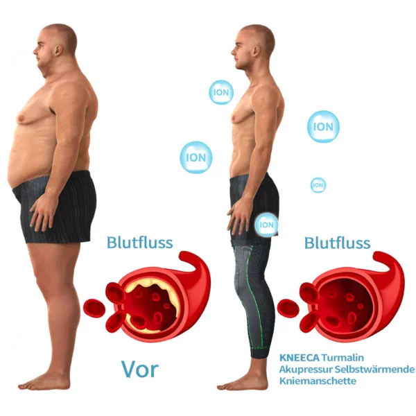 KNEECA Tourmaline Selbstheizende Kniehülse - Image 4