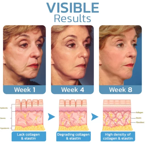 flysmus™ BotoxLUX Collagen Anti Aging Serum - Image 4