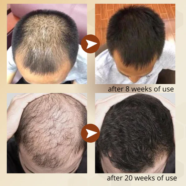 Regrowth™ Nourishing Ginger Spray - Image 4