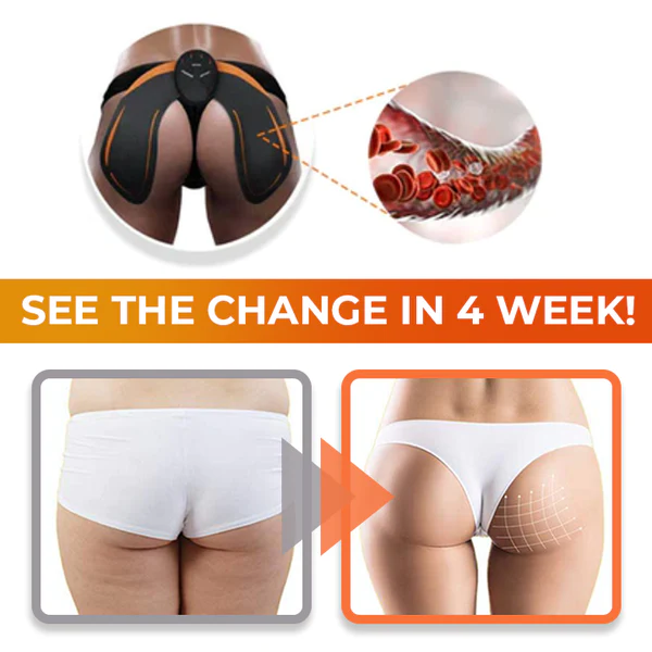 ShapeZ™ Buttock Lifting Instrument - Image 6