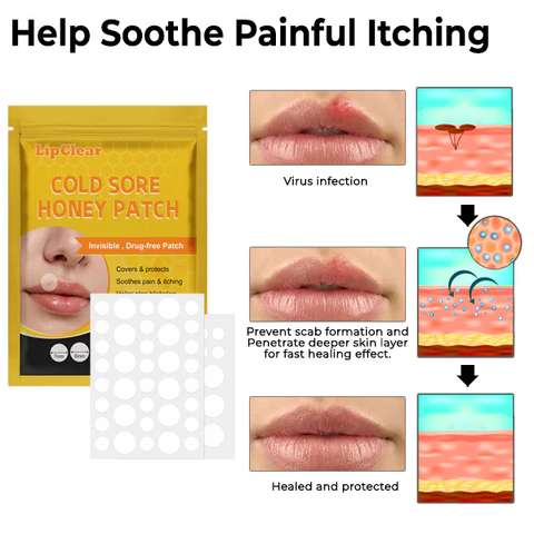 LipClear Cold Sore Honey Patch - Image 5