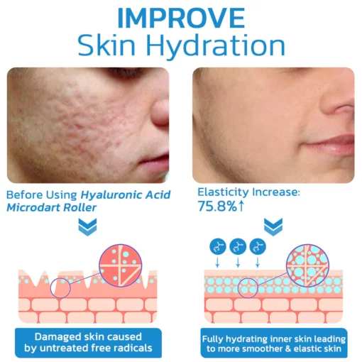 HyaluFix ™ Pockmark Heal Microdart Roller - Image 5