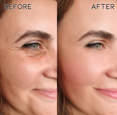 YouthRegain Korean Micro-Darts Eye Patches - Image 4