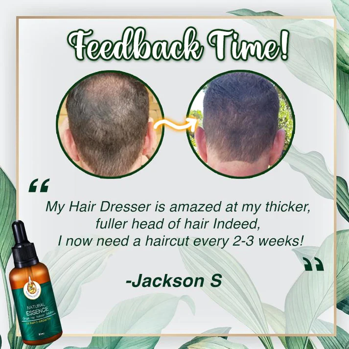 Ginger 7X Rapid Hairup Serumđ„Refund immediately if there is no effect after use! - Image 3