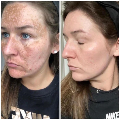 Fivfivgo™ Advanced Skin Brightening Serum - Image 8