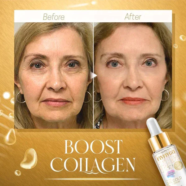Fivfivgo™ SkinRevive Kollagen-Booster-Serum - Image 5