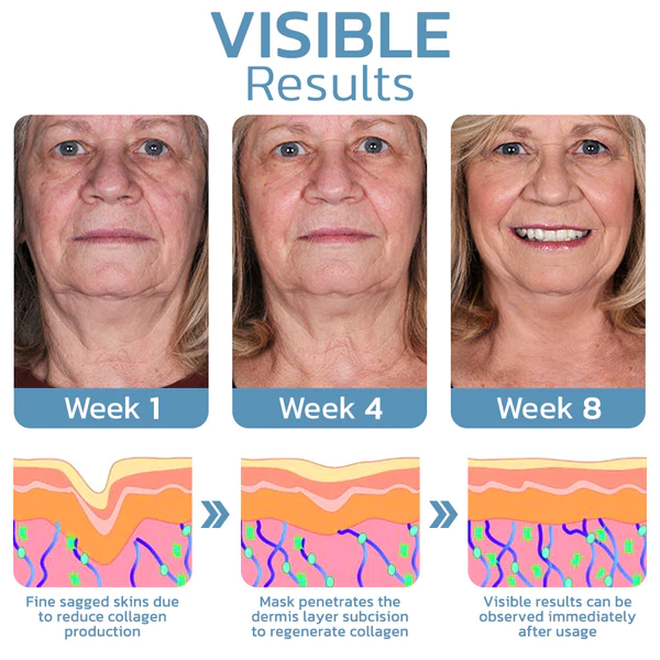 flysmus™ Premium Ziegenmilch Kollagen Straffende Halsmaske - Image 7