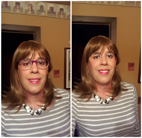 REBRIGHT™ Ultra Eye Therapy Lubricant Eye Drops, Perservative Free, Prevent and Relieve Eye Diseases - Image 4