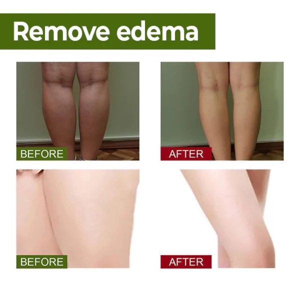 SEFUDUN™ Natural Bamboo Charcoal Health Foot Patch - Image 7