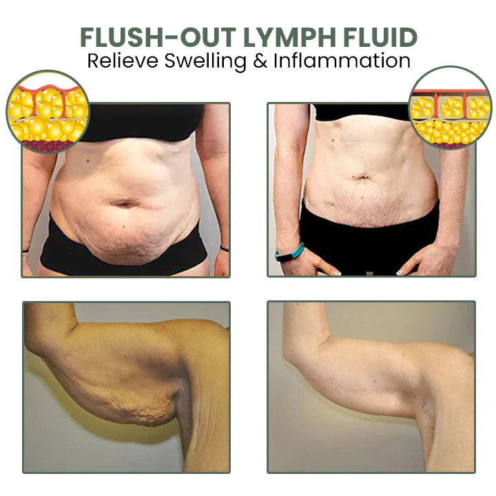 Oveallgo™ Wermut CelluliteWegMit Hautstraffungscreme - Image 8