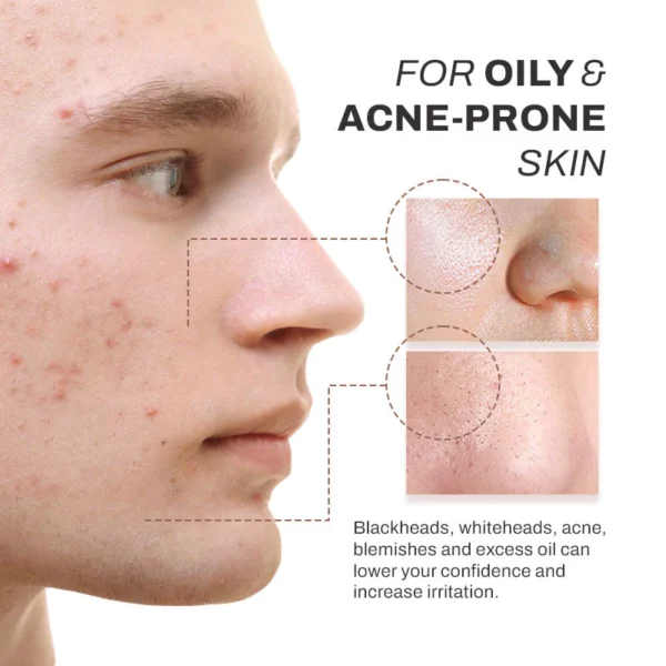 ATTDX Carotene DeepPurifying BubbleClay Mask - Image 4