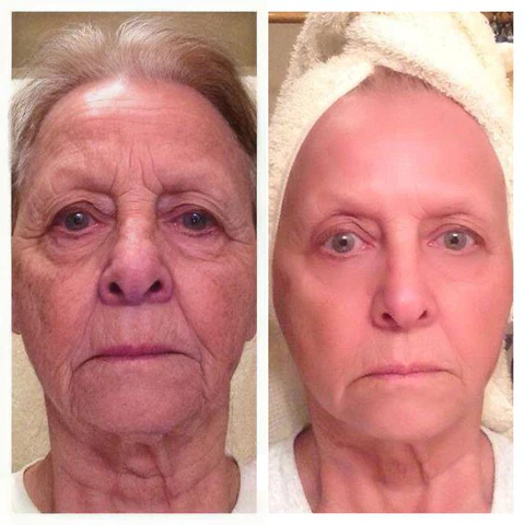 BeYouth™ Pro-Collagen and Ceramide Lifting Ampoule Serum - Image 4