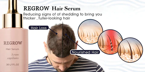 REGROW™ Hair Serum - Image 3