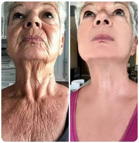 Oveallgo™ YOUNG Golden Age Refining Anti-Aging Serum - Image 7