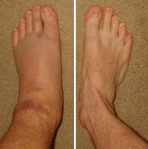 AEXZR™ Kidney Boost Patch - Image 9