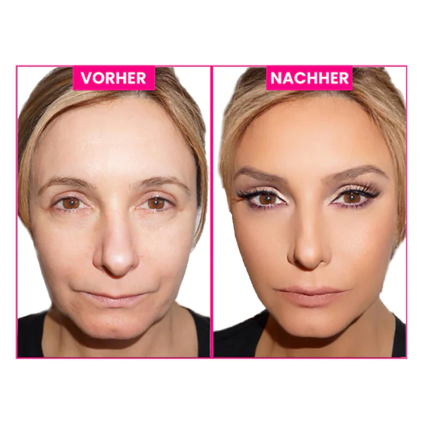 Powerlifter™ Unsichtbares Gesichtsband - Image 3