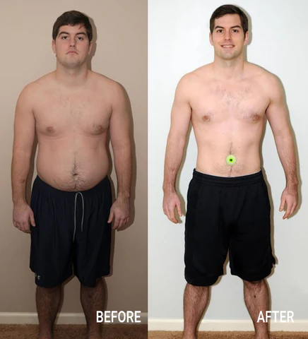 AirFlow® Intense IONSTech Botanical Extracts Burst Beads Patch PRO - Image 8