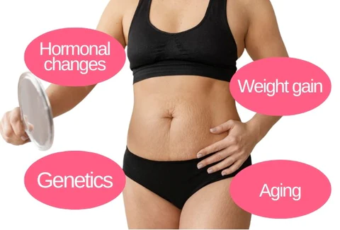 AEXZR™ Stretchmark Repair Cream - Image 4