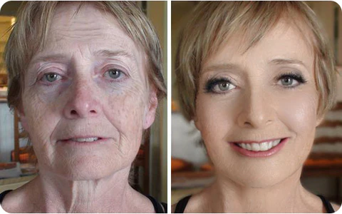 Oveallgo™ YOUNG Golden Age Refining Anti-Aging Serum - Image 6