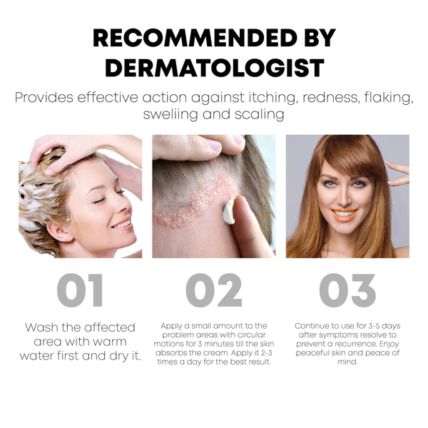 ATTDX SeborrhoeicDermatitis ScalpCare TreatmentCream - Image 3