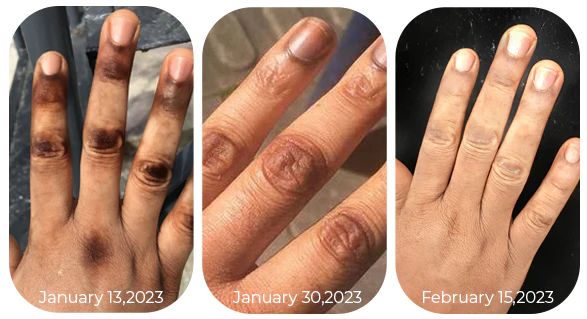 Fivfivgo™ Advanced Skin Brightening Serum - Image 7