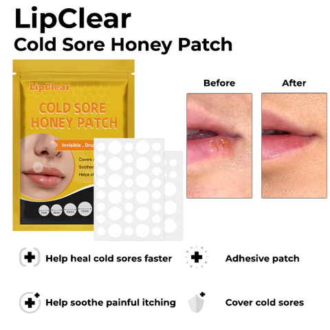 LipClear Cold Sore Honey Patch - Image 3