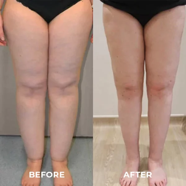 SEFUDUN™ Natural Bamboo Charcoal Health Foot Patch - Image 9