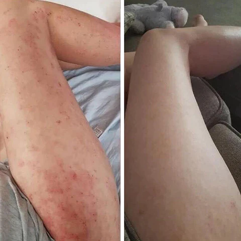 AEXZR™ Kidney Boost Patch - Image 8