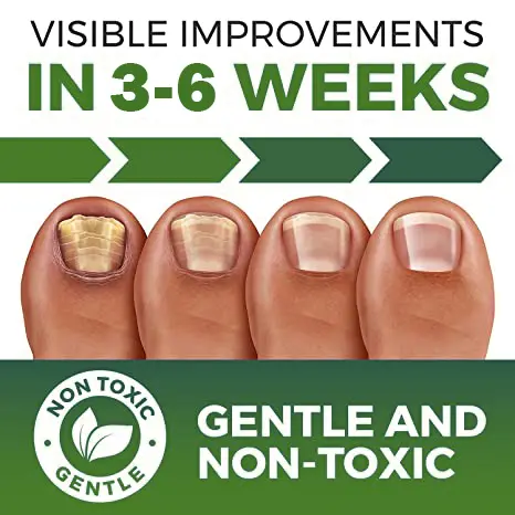 FootFree™ Antifungal – Professional Strength - Image 4