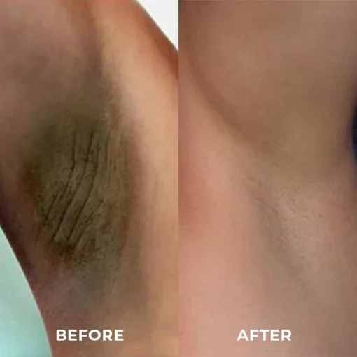 BioLap™ Dark Spot Correcting Cream - Image 3